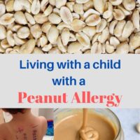 living with a child with peanut allergy